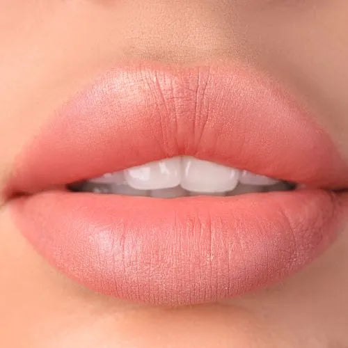 RadiaNt Dermal Filler Soft