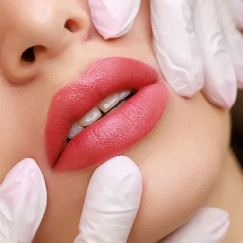 RadiaNt Dermal Filler Soft