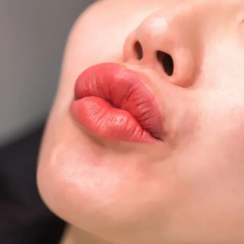 RadiaNt Dermal Filler Derm