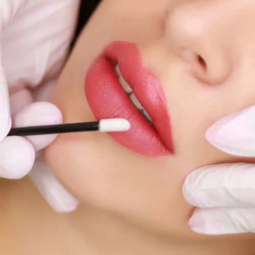 RadiaNt Dermal Filler Ultra